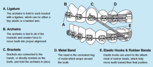 Courtesy of the American Association of Orthodontists